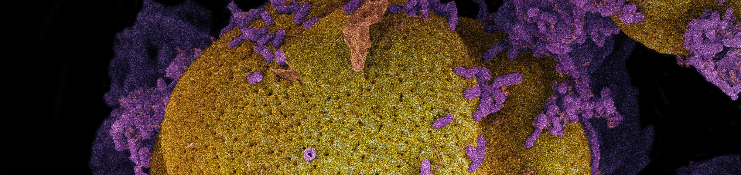 Pollen covered in bacteria from the honey bee jindgut